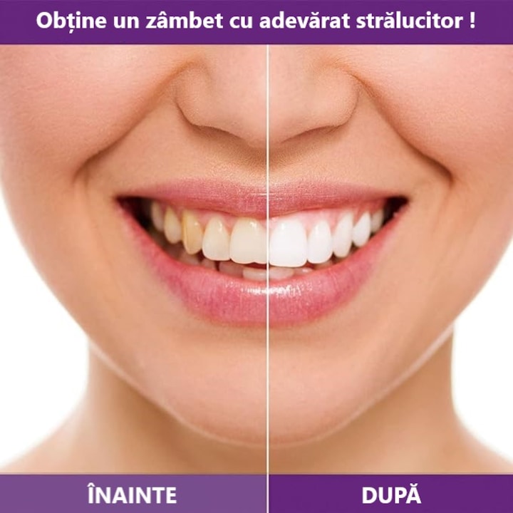 Spuma dentara cu efect de albire 30 ml - 1 | YEO