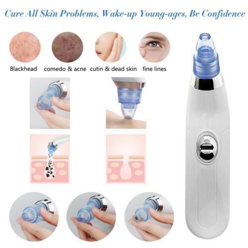 Aspirator facial Derma Suction, pentru un ten curat